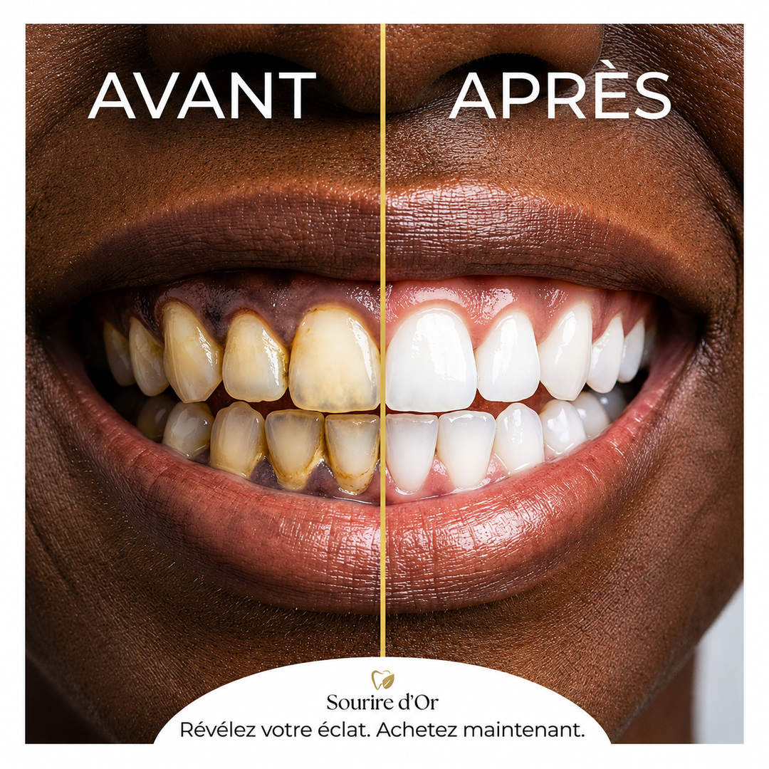 YECUCE-Solution Anti-Dents Jaunes et carrie dentaire