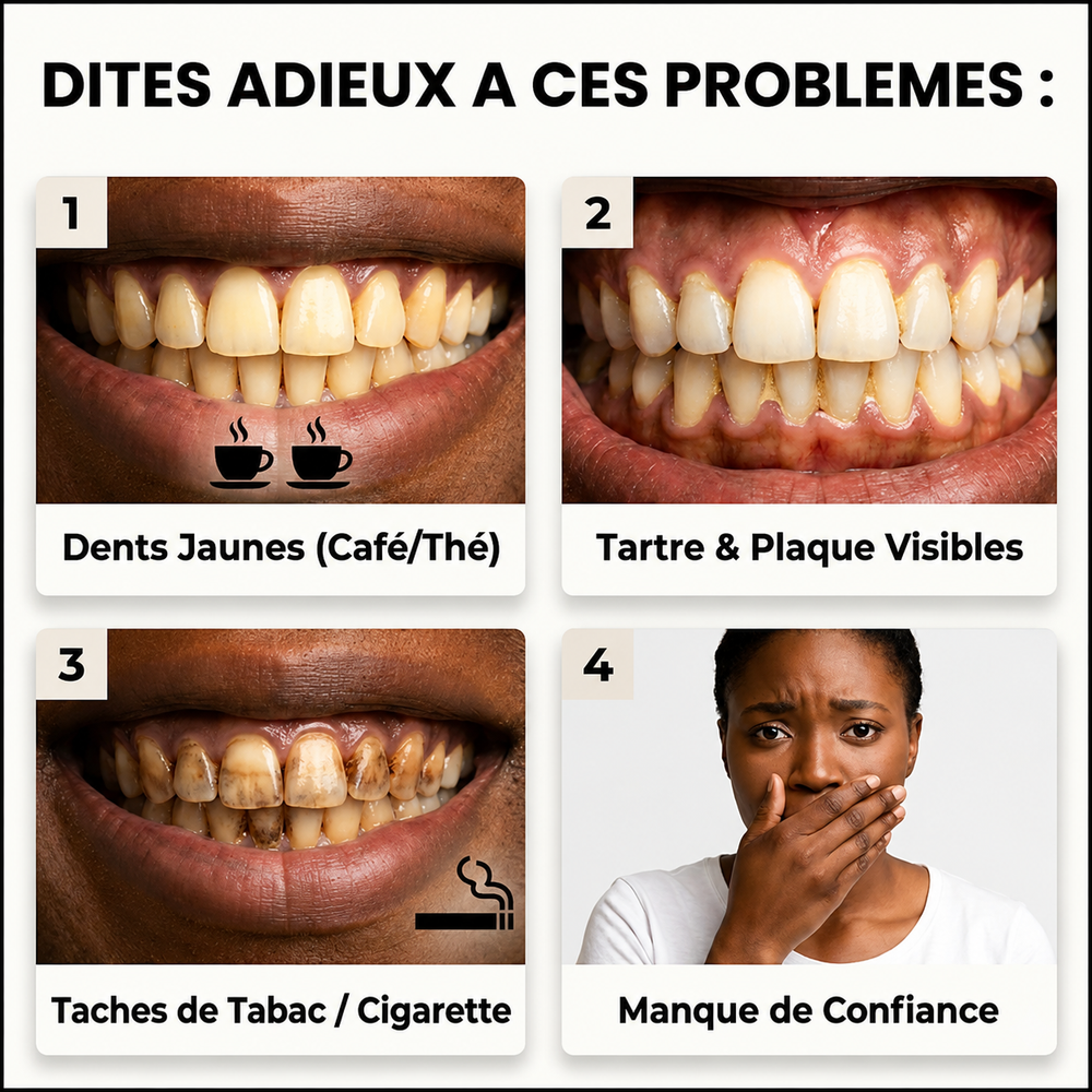 YECUCE-Solution Anti-Dents Jaunes et carrie dentaire