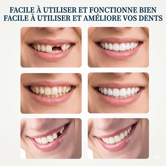BLSEX-Prothèse Anti-Dents Cassées