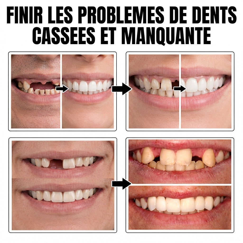 Moldable False Teeth™ – Solution pour Dents Cassées ou Manquantes