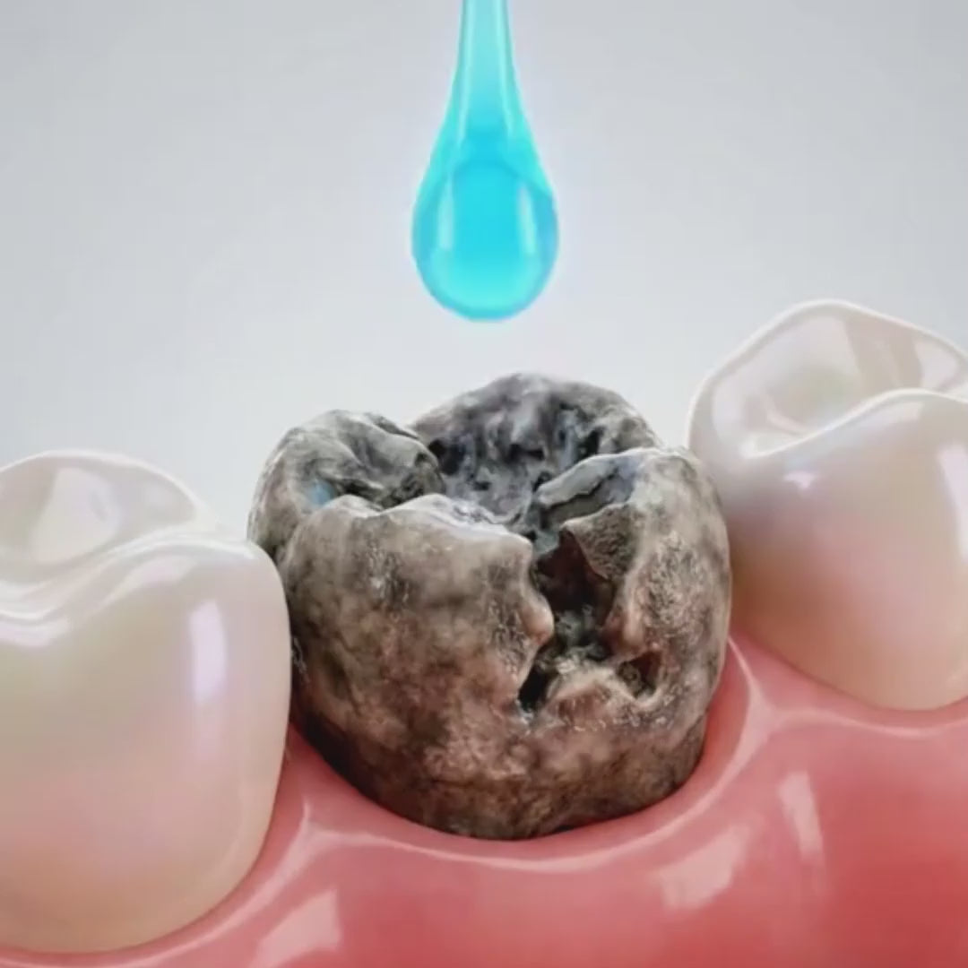 YECUCE-Solution Anti-Dents Jaunes et carrie dentaire